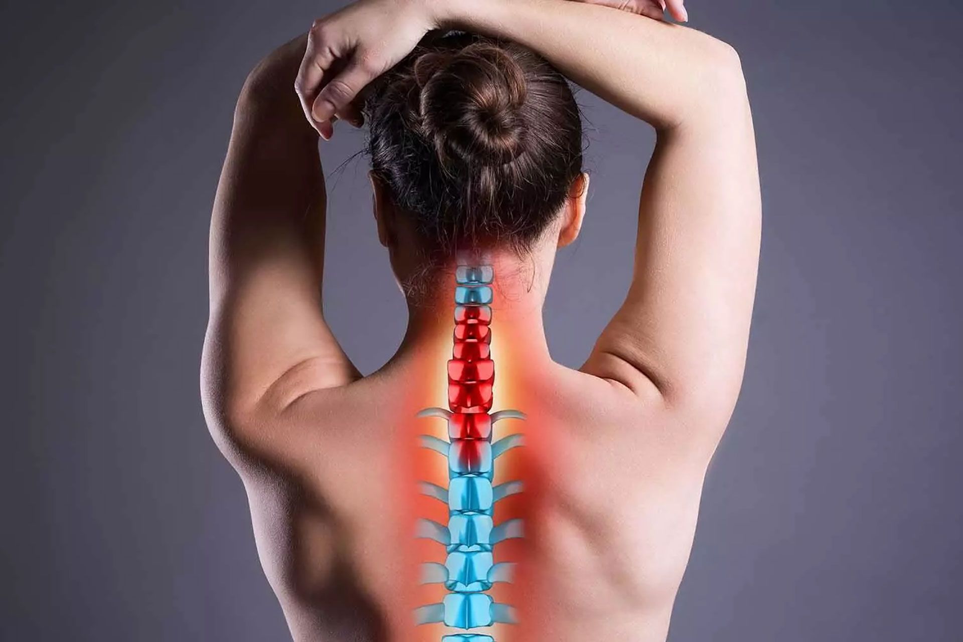  Myofascial Pain Syndrome